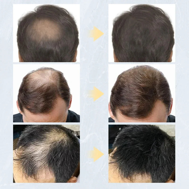27.5g 9 cores fibras de cabelo queratina recrescimento em pó spray fibra de construção de cabelo poudre pós de recrescimento instantâneo perda de cabelo esconder